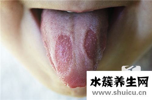 舌癌的早期癥狀圖片