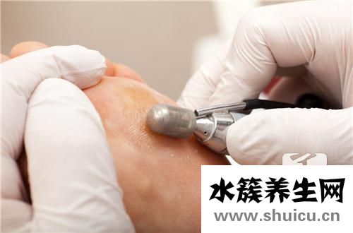 多久去一次角質