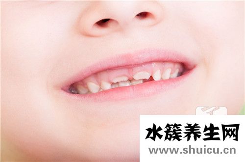 帶牙套的最佳年齡