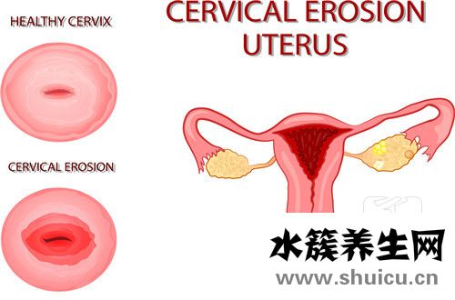 子宮內(nèi)膜厚怎么辦