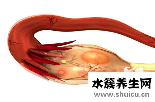 卵巢功能衰退怎么調理