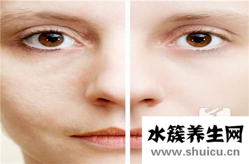 臉上的斑是怎么形成的