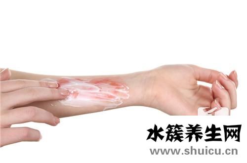 被老鼠抓傷了怎么辦