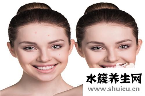 毛囊炎治療方法