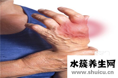 身體濕氣重如何排濕