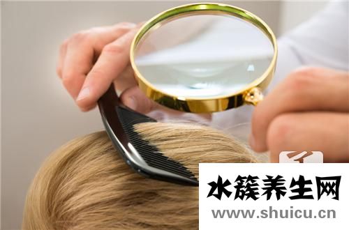 頭皮屑特別多怎么辦