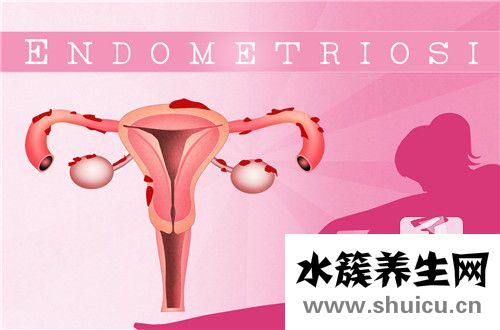 腺肌癥是怎么回事