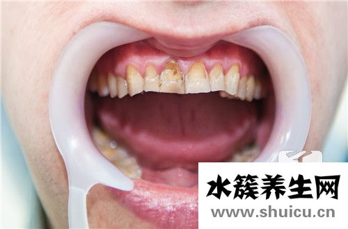 活髓切斷術(shù)