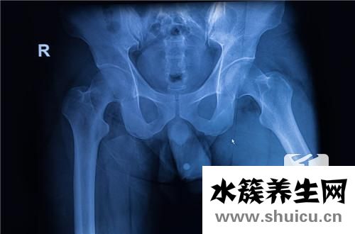 中心靜脈導管包