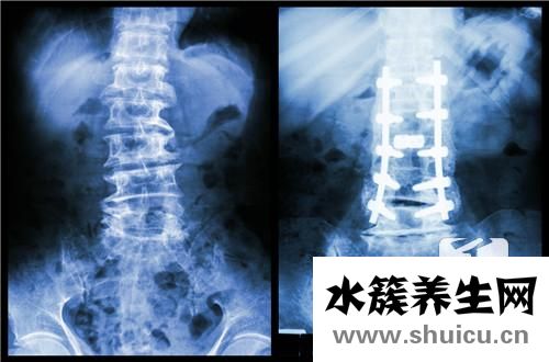 平躺睡覺腰疼怎么回事