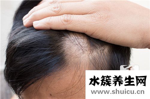 鬼剃頭最快的治療方法