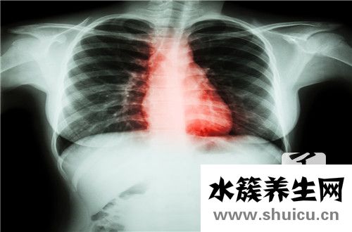 心臟瓣膜關閉不全