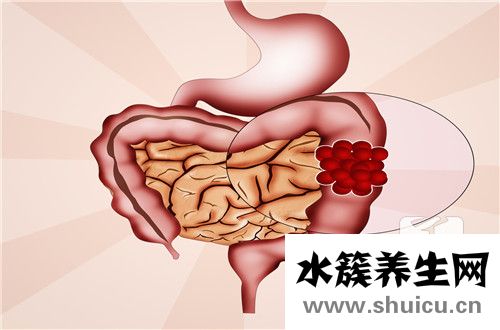 直腸鏡檢查前準備