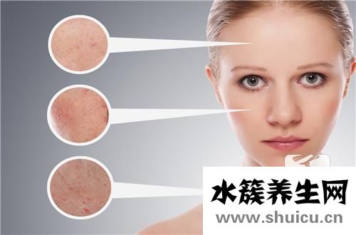 火針治療痤瘡