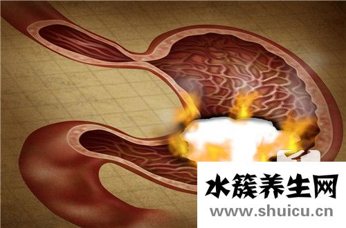 胃熱的癥狀如何去胃火