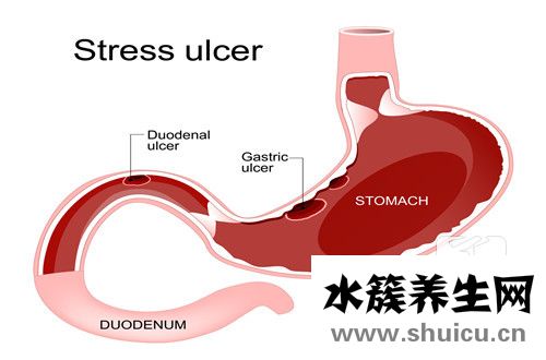 胃熱的癥狀如何去胃火