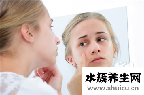 青春痘怎么處理