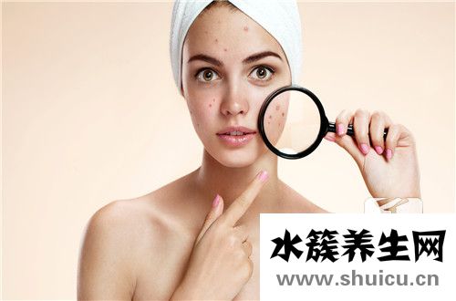 青春痘多久才會好