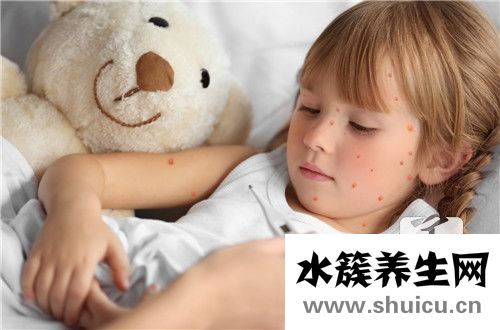 寶寶發燒后出疹子