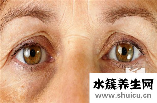 眼瞼皺紋