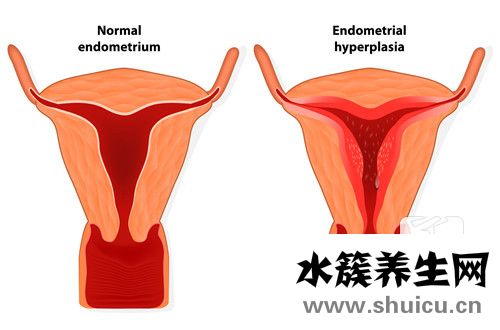 節育環的副作用