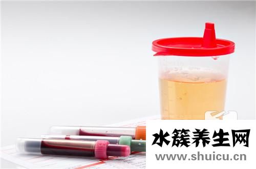 血尿酸高的原因