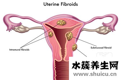 子宮內膜薄吃什么好