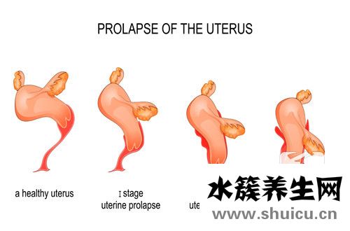 子宮內膜薄吃什么好
