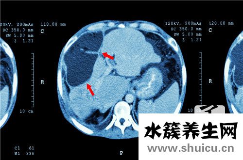 乙肝表面抗原弱陽(yáng)性