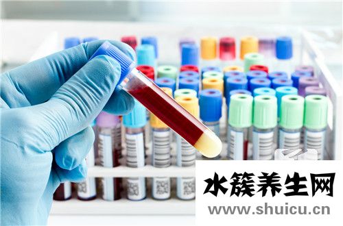 轉氨酶偏高的原因