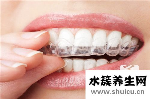 冷光美白牙齒效果