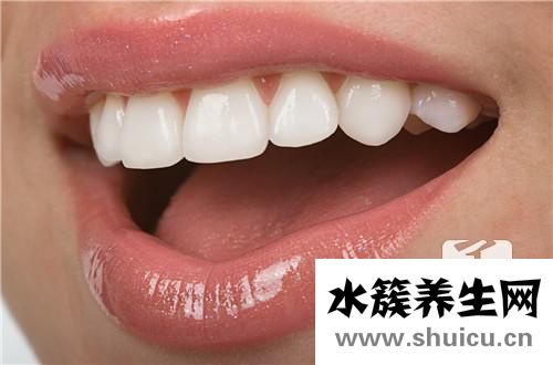 洗牙可以美白牙齒嗎