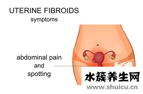 子宮肌瘤是什么病