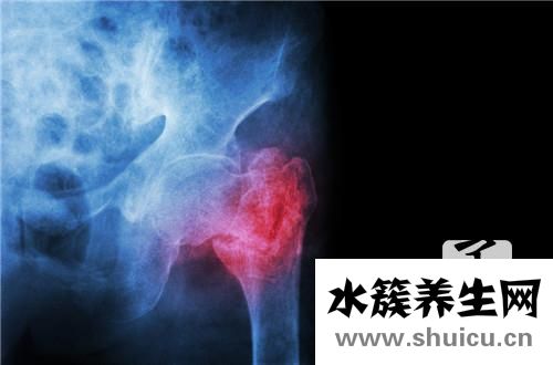 如何治療盆腔炎