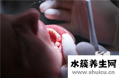 牙周炎會傳染嗎