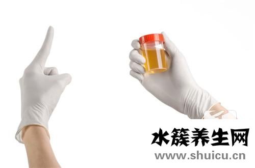 尿素氮偏高的原因