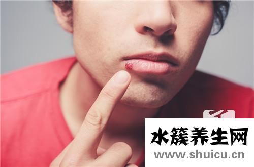 上火嘴唇起泡