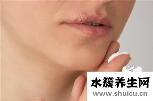 病毒性皰疹怎么治療