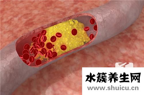 糖尿病有哪些癥狀