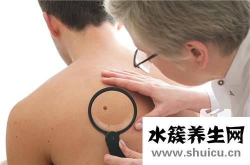 神經(jīng)膠質(zhì)瘤