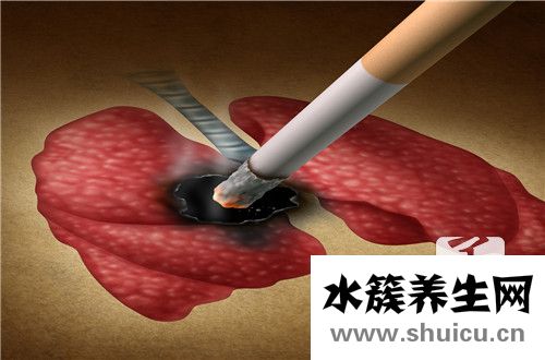 神經(jīng)膠質(zhì)瘤