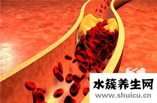 血小板計數偏高