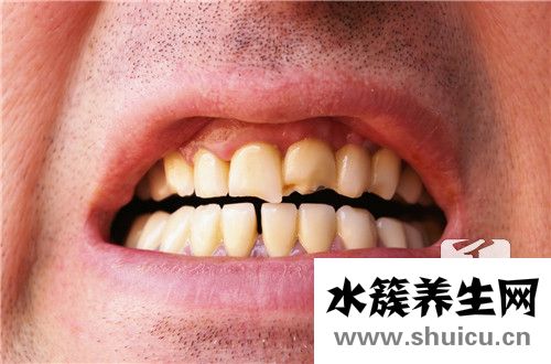 牙齒松動是什么原因