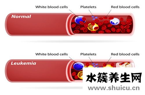 紅細胞壓積偏低