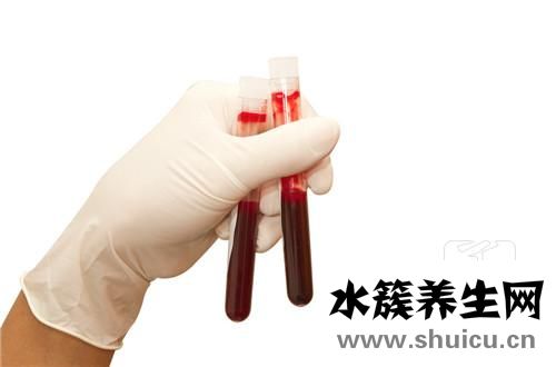 嗜酸性粒細胞偏低