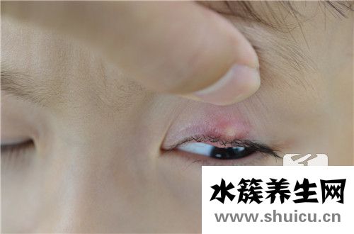 眼角內(nèi)長(zhǎng)了個(gè)小白膿點(diǎn)