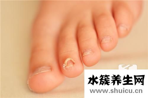 長出來的指甲是乳白色