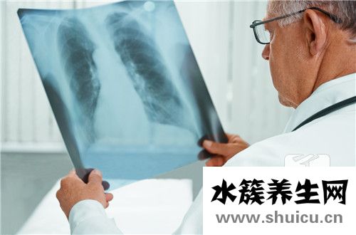 結(jié)核抗體檢測(cè)