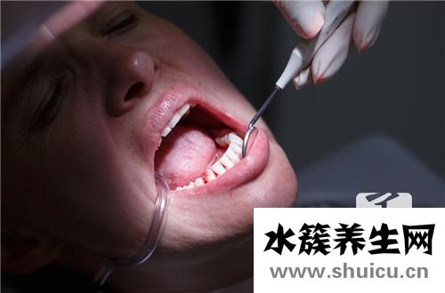 牙縫黑色污垢圖片