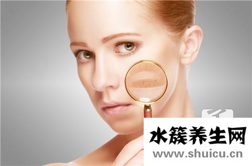 膠帶印怎么去除